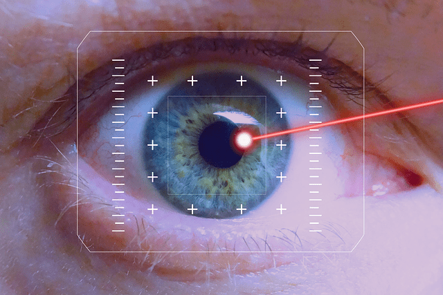 eye laser surgery